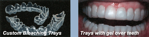 Olney Dental