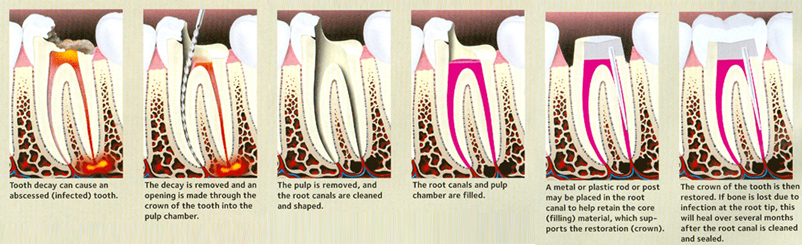 Olney Dental